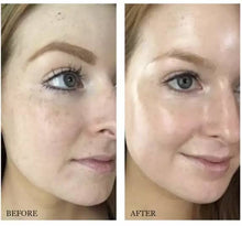 Cargar imagen en el visor de la galería, “Alpha Arbutin 2%” The Ordinary